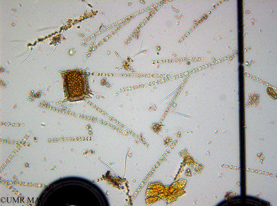 phyto/Guinea golf/Wouri_estuary_Manoka/YNkouefuthNfongmo_these 2022-2023/Odontella aurita (Manoka_SURF_2023_iden24230626_001).TIF(copy)_thumb.jpg